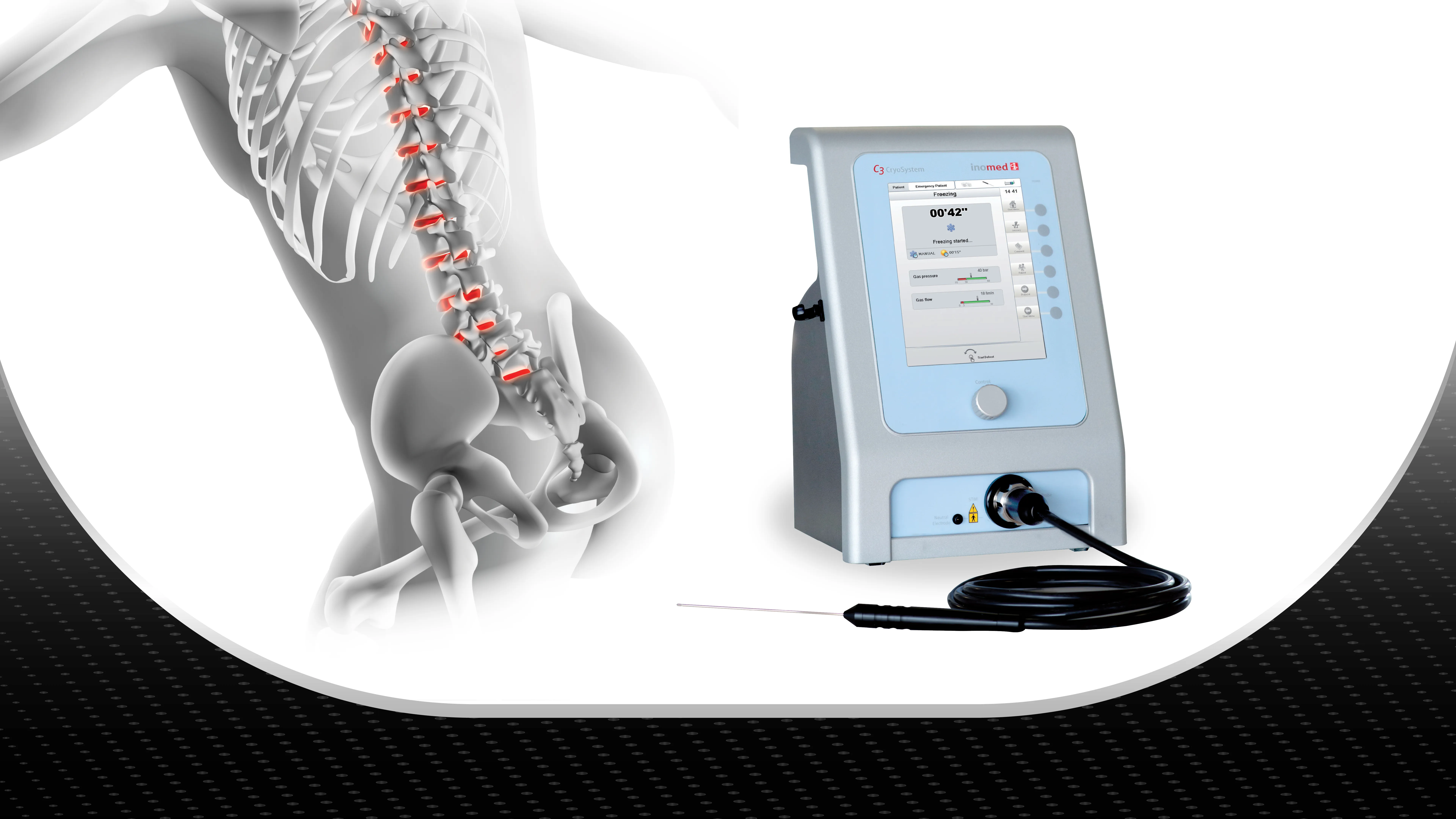 Why Choose Cryo C3 System?