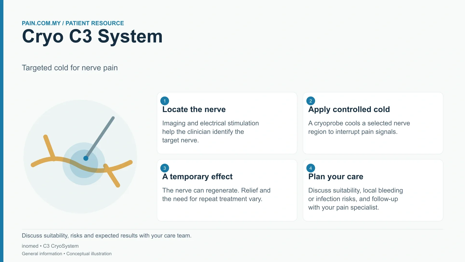 Cryo C3 System infographic
