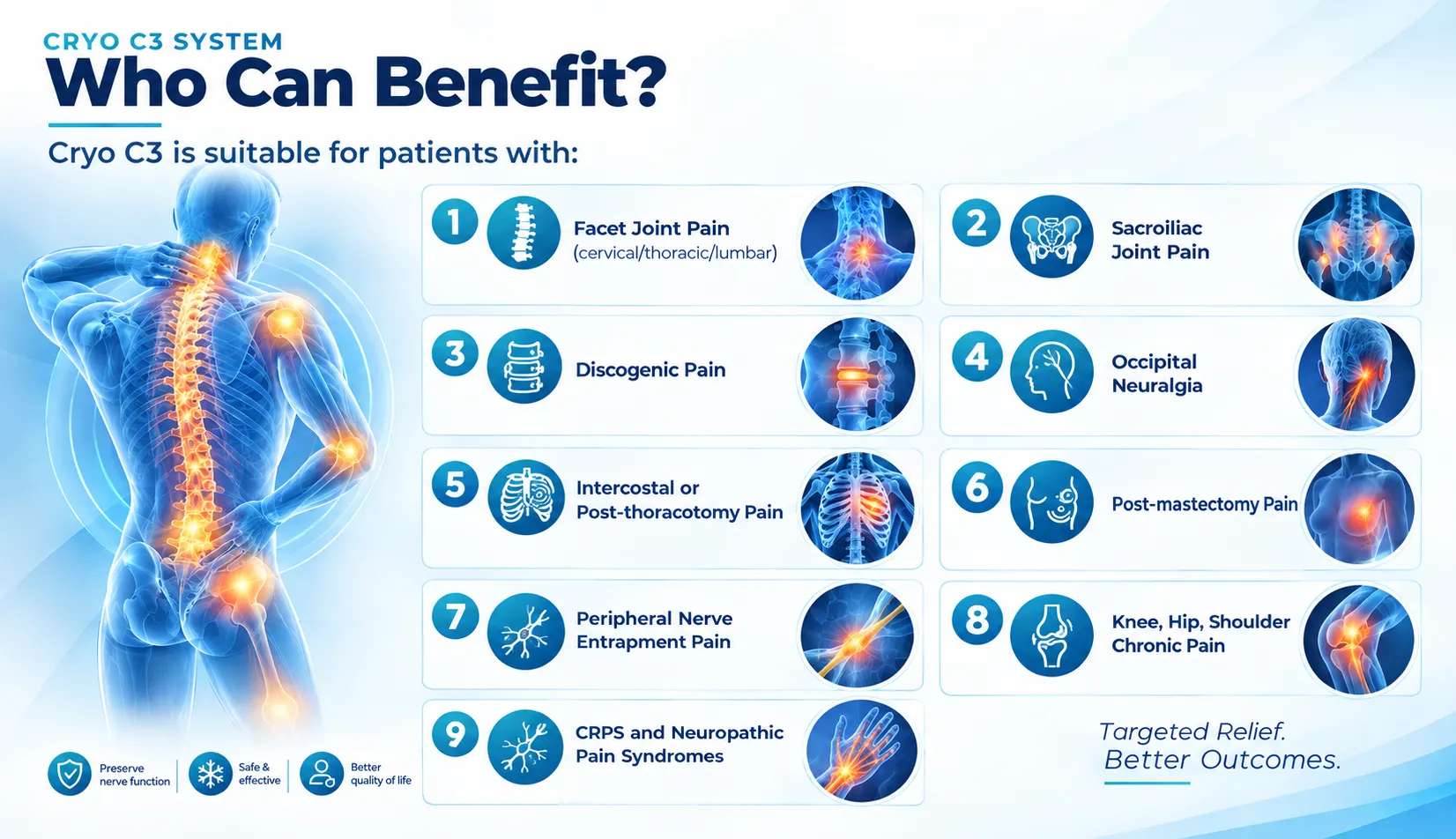 Cryo C3 System infographic
