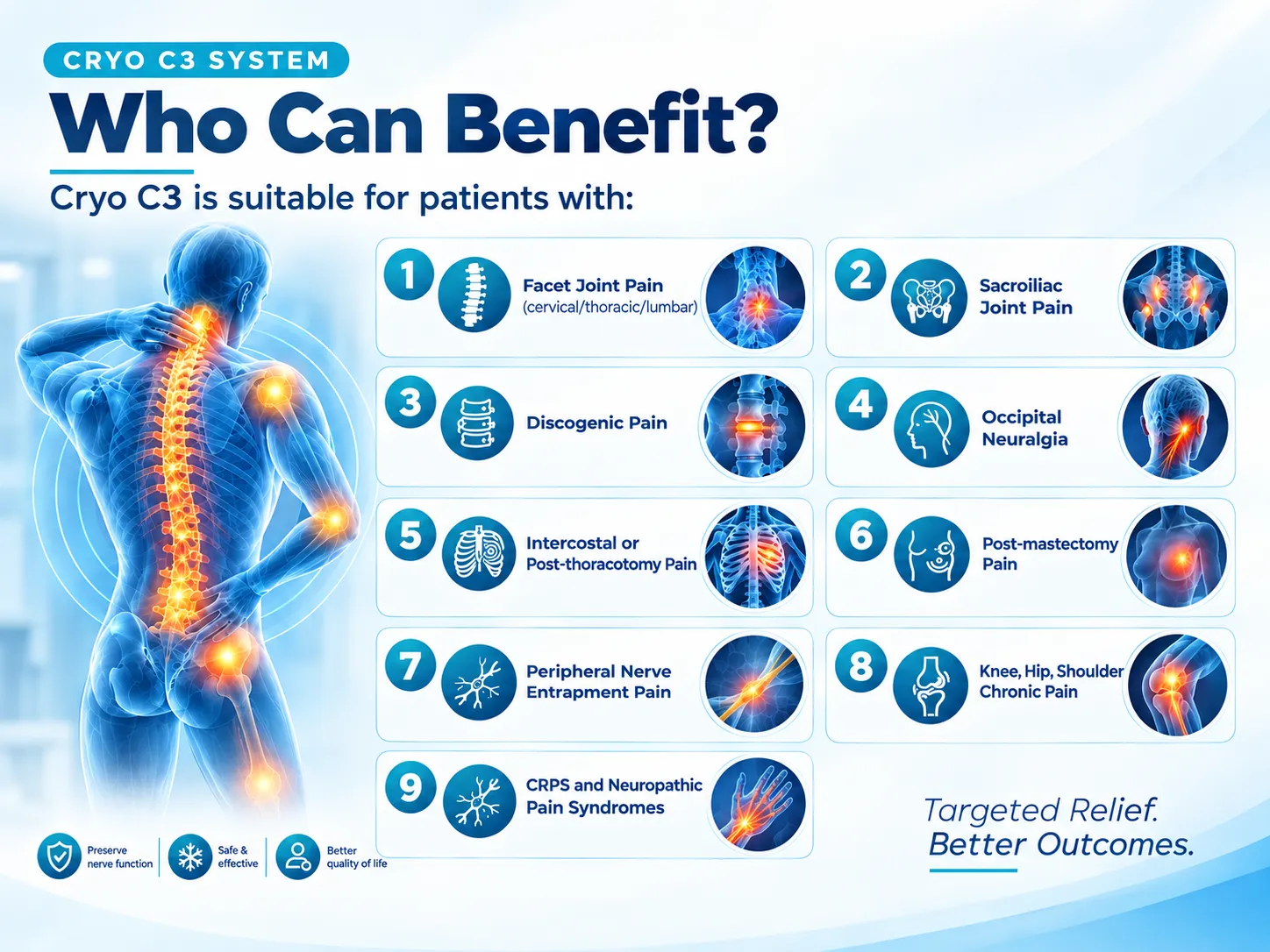 Cryo C3 System infographic