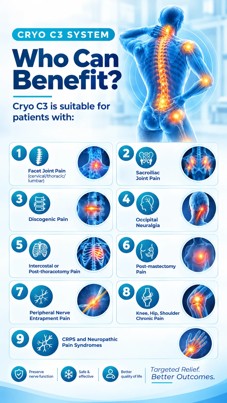 Cryo C3 System infographic